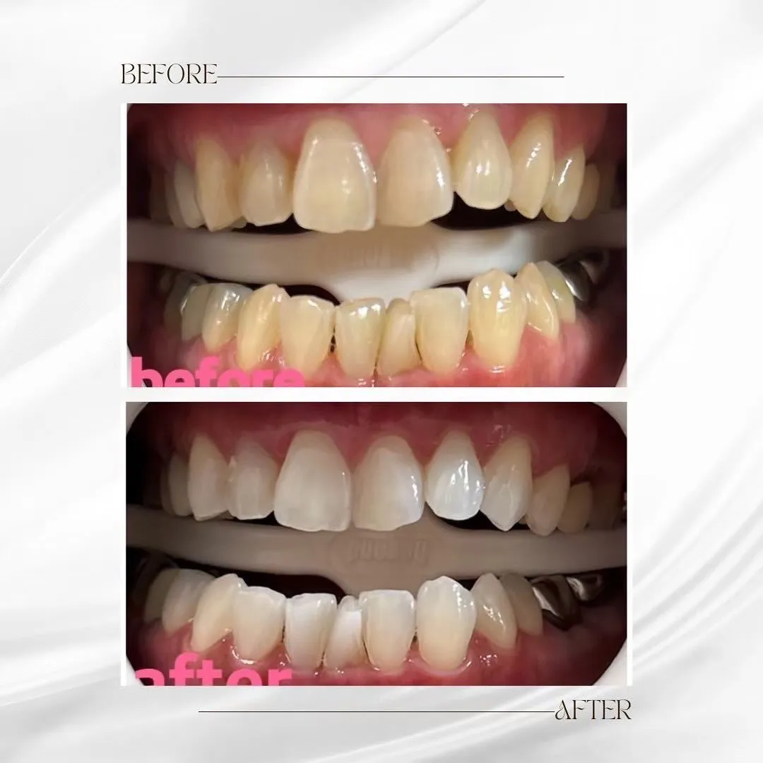 この度、ホワイトニングサロンBellissimoは