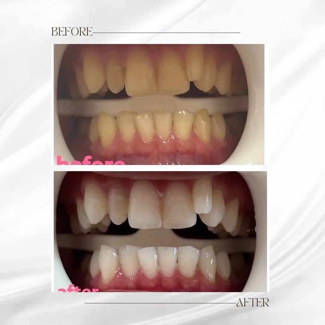 この度、ホワイトニングサロンBellissimoは