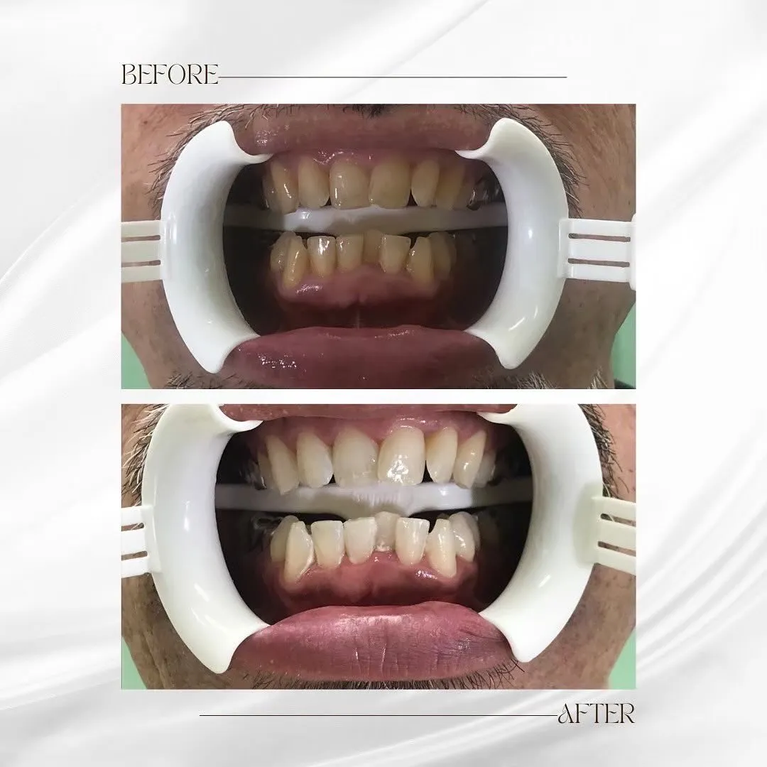 この度、ホワイトニングサロンBellissimoは