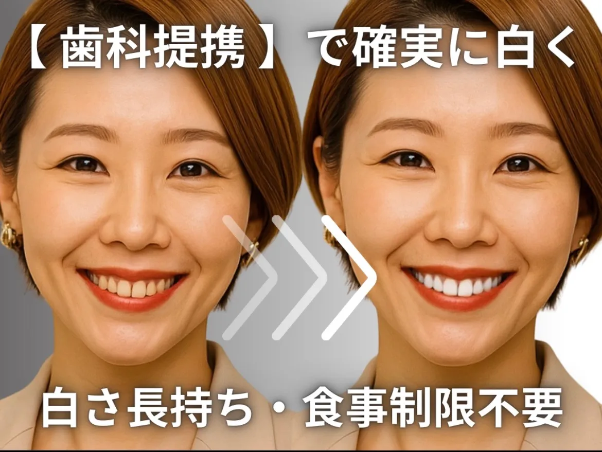 2月から当日歯科ホワイトニング可能に！