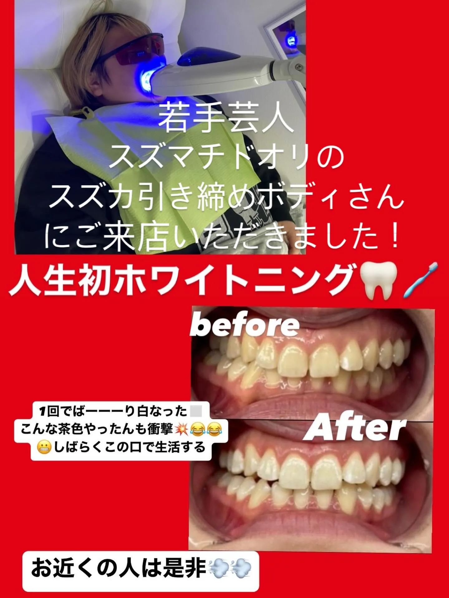 #歯科提携ホワイトニング